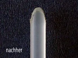 شعيرات ذات أطراف مستديرة · Hilzinger–Thum